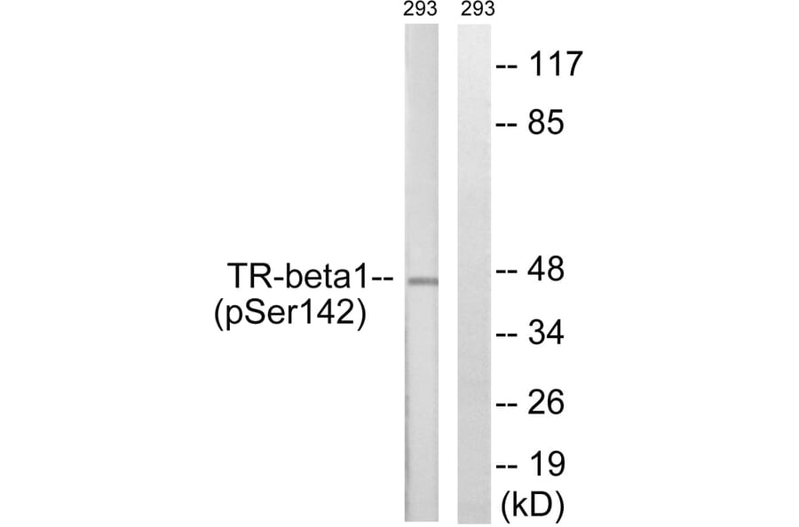 Western Blot - Anti-TR-beta1 (phospho Ser142) Antibody (A8442) - Antibodies.com