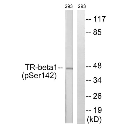 Western Blot - Anti-TR-beta1 (phospho Ser142) Antibody (A8442) - Antibodies.com