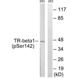 Western Blot - Anti-TR-beta1 (phospho Ser142) Antibody (A8442) - Antibodies.com