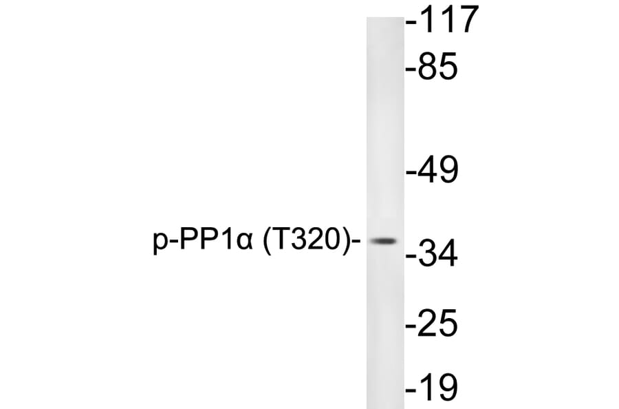 Western Blot - Anti-PP1alpha (phospho Thr320) Antibody (P12-1047) - Antibodies.com
