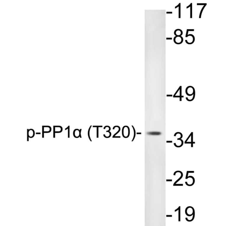 Western Blot - Anti-PP1alpha (phospho Thr320) Antibody (P12-1047) - Antibodies.com
