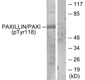 Western Blot - Anti-Paxillin (phospho Tyr118) Antibody (A7192) - Antibodies.com