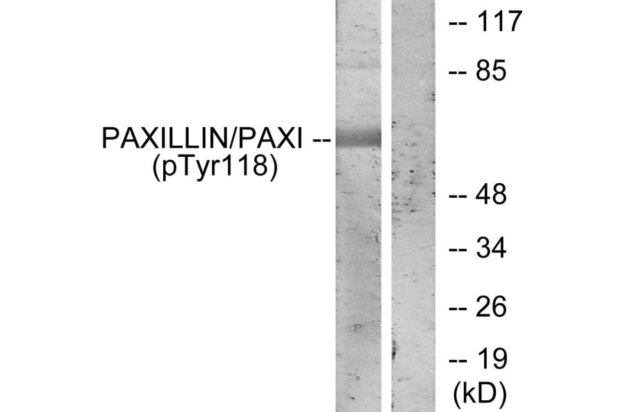 Western Blot - Anti-Paxillin (phospho Tyr118) Antibody (A7192) - Antibodies.com