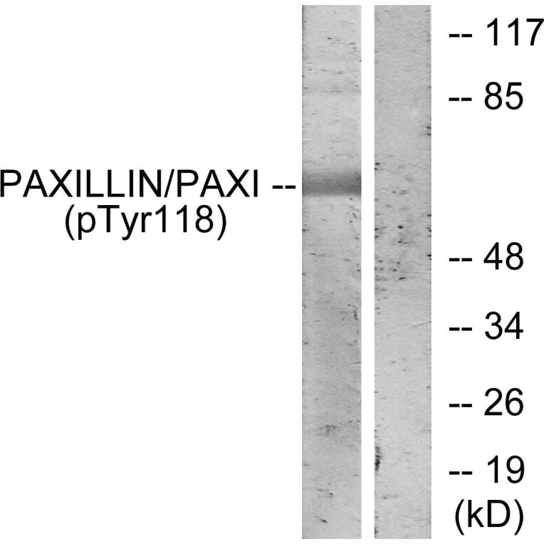 Western Blot - Anti-Paxillin (phospho Tyr118) Antibody (A7192) - Antibodies.com