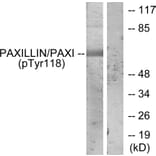 Western Blot - Anti-Paxillin (phospho Tyr118) Antibody (A7192) - Antibodies.com
