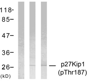 Western Blot - Anti-p27 Kip1 (phospho Thr187) Antibody (A7177) - Antibodies.com