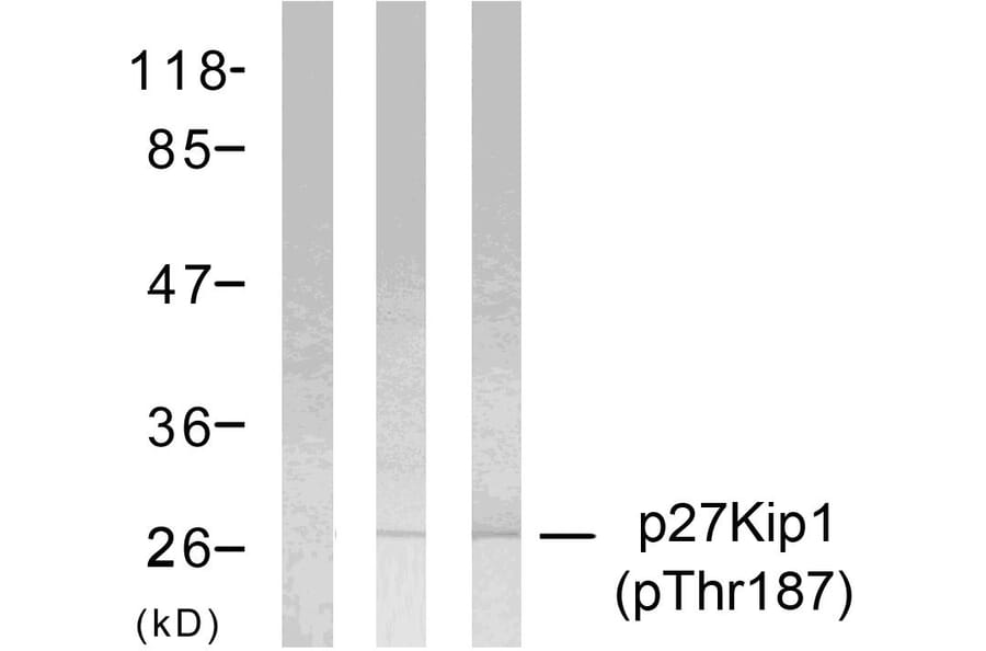 Western Blot - Anti-p27 Kip1 (phospho Thr187) Antibody (A7177) - Antibodies.com