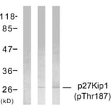 Western Blot - Anti-p27 Kip1 (phospho Thr187) Antibody (A7177) - Antibodies.com