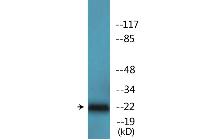 Western Blot - Anti-p27 Kip1 (phospho Thr187) Antibody (P12-1158) - Antibodies.com