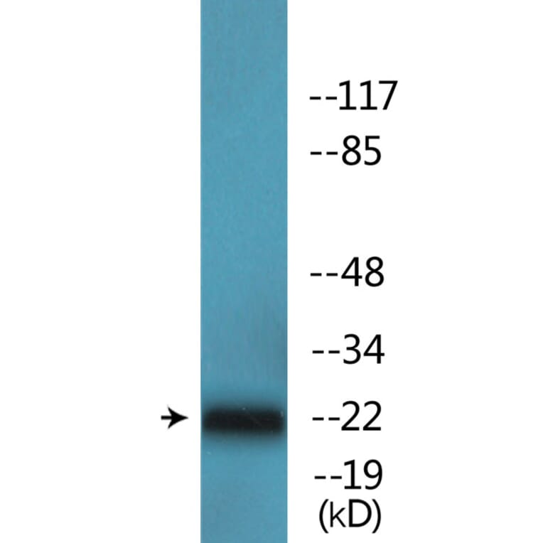 Western Blot - Anti-p27 Kip1 (phospho Thr187) Antibody (P12-1158) - Antibodies.com