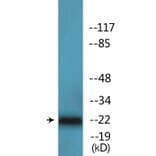 Western Blot - Anti-p27 Kip1 (phospho Thr187) Antibody (P12-1158) - Antibodies.com