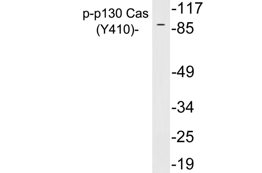 Western Blot - Anti-p130 Cas (phospho Tyr410) Antibody (P12-1039) - Antibodies.com