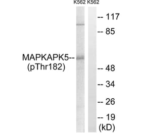 Western Blot - Anti-MAPKAPK5 (phospho Thr182) Antibody (A8364) - Antibodies.com