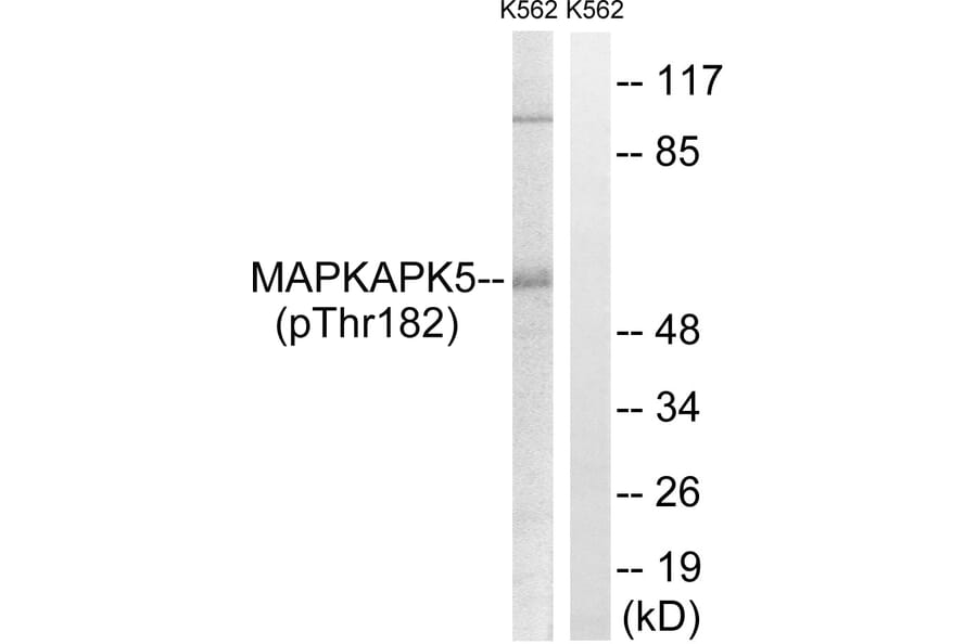 Western Blot - Anti-MAPKAPK5 (phospho Thr182) Antibody (A8364) - Antibodies.com