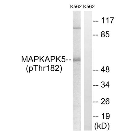 Western Blot - Anti-MAPKAPK5 (phospho Thr182) Antibody (A8364) - Antibodies.com