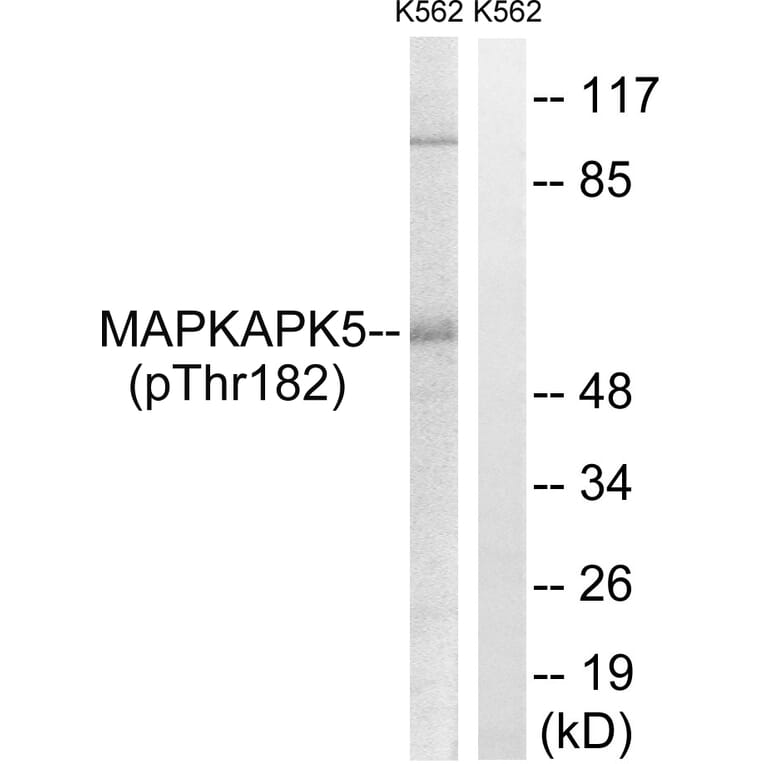 Western Blot - Anti-MAPKAPK5 (phospho Thr182) Antibody (A8364) - Antibodies.com