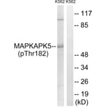 Western Blot - Anti-MAPKAPK5 (phospho Thr182) Antibody (A8364) - Antibodies.com