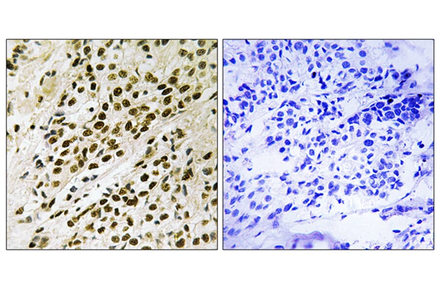 Immunohistochemistry - Anti-MAPKAPK5 (phospho Thr182) Antibody (A8364) - Antibodies.com