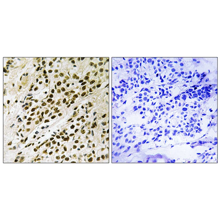 Immunohistochemistry - Anti-MAPKAPK5 (phospho Thr182) Antibody (A8364) - Antibodies.com