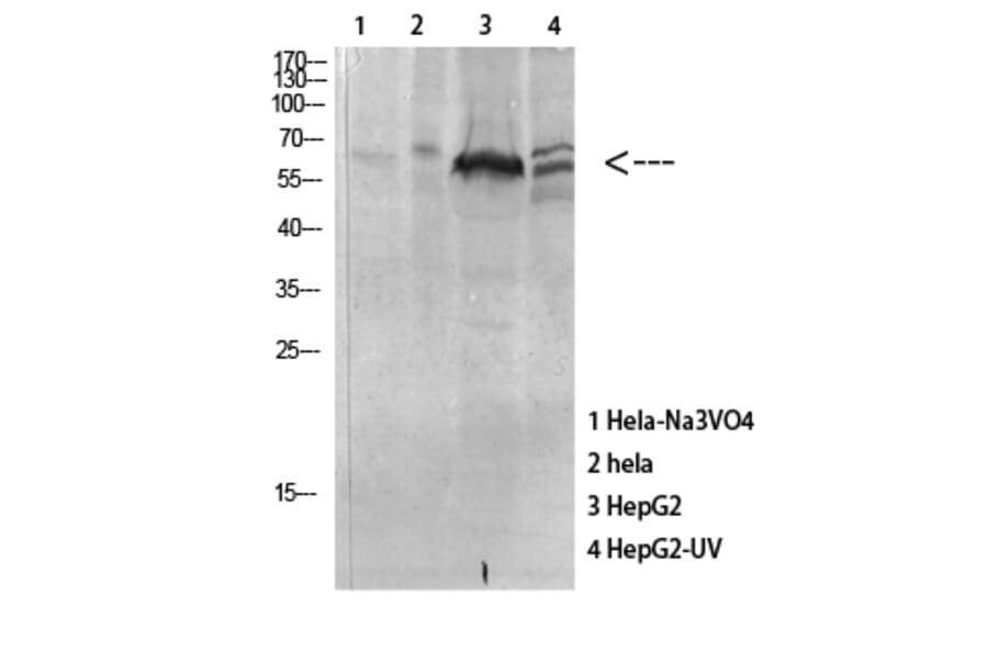 Western Blot - Anti-MAPKAPK5 (phospho Thr182) Antibody (A8364) - Antibodies.com