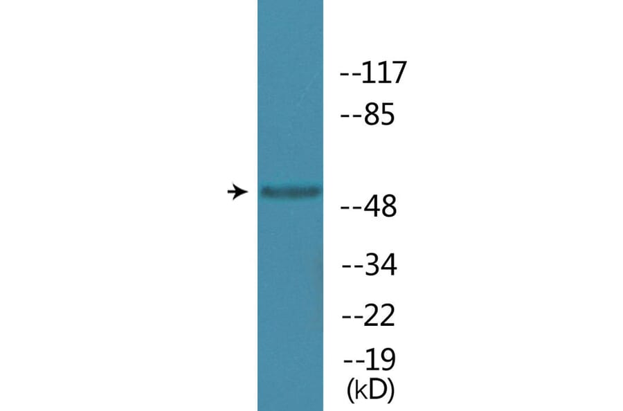 Western Blot - Anti-MAPKAPK5 (phospho Thr182) Antibody (P12-1144) - Antibodies.com