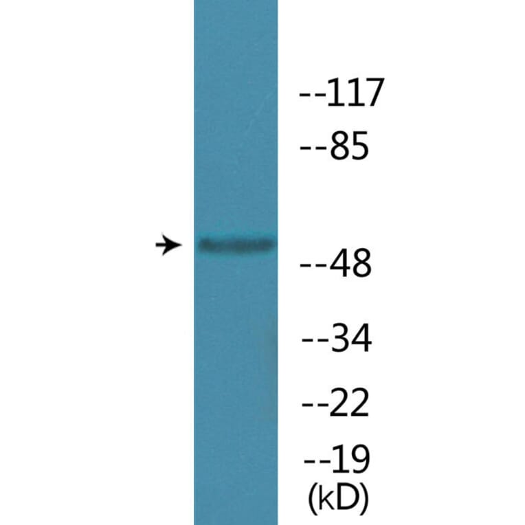 Western Blot - Anti-MAPKAPK5 (phospho Thr182) Antibody (P12-1144) - Antibodies.com
