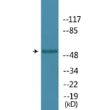 Western Blot - Anti-MAPKAPK5 (phospho Thr182) Antibody (P12-1144) - Antibodies.com