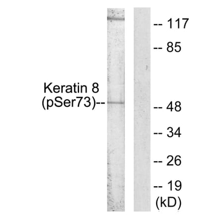 Western Blot - Anti-Keratin 8 (phospho Ser73) Antibody (A0017) - Antibodies.com