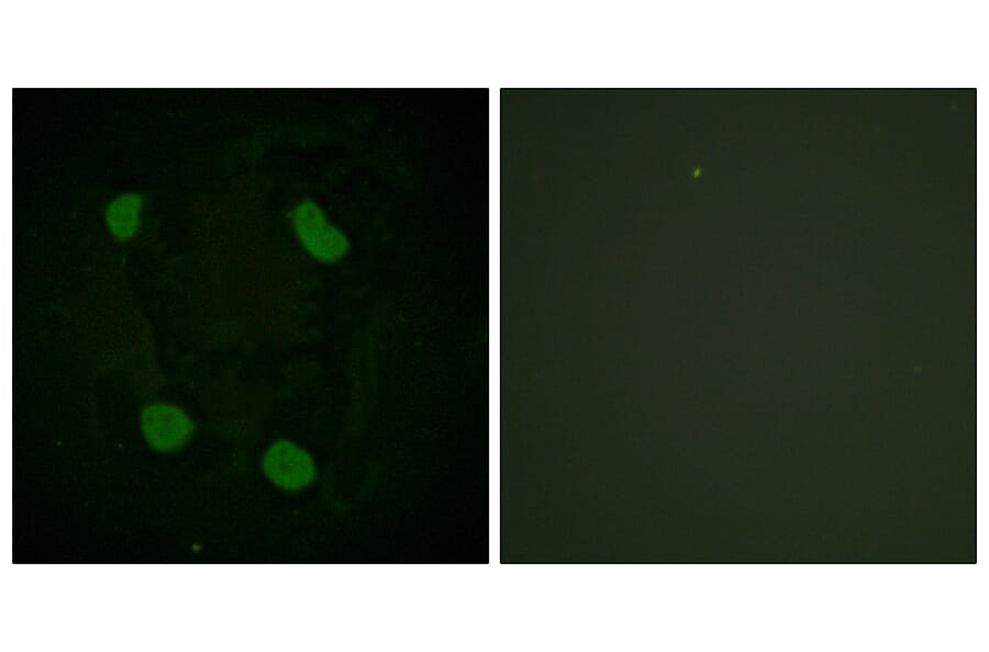 Immunofluorescence - Anti-Histone H3 (acetyl Lys14) Antibody (D0007) - Antibodies.com