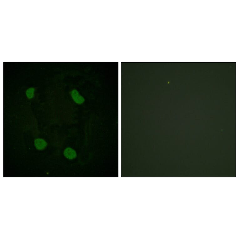 Immunofluorescence - Anti-Histone H3 (acetyl Lys14) Antibody (D0007) - Antibodies.com