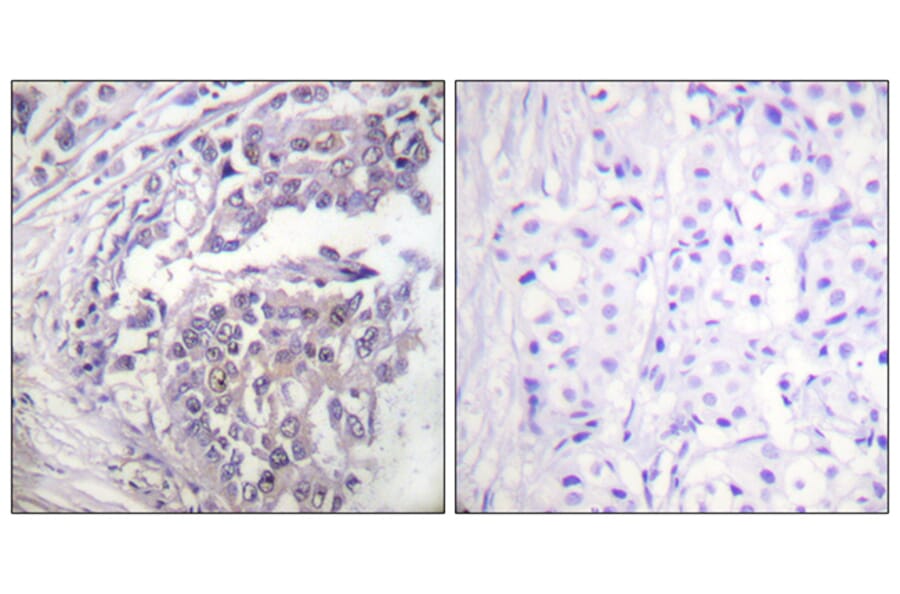Immunohistochemistry - Anti-Histone H2B (acetyl Lys5) Antibody (D0003) - Antibodies.com