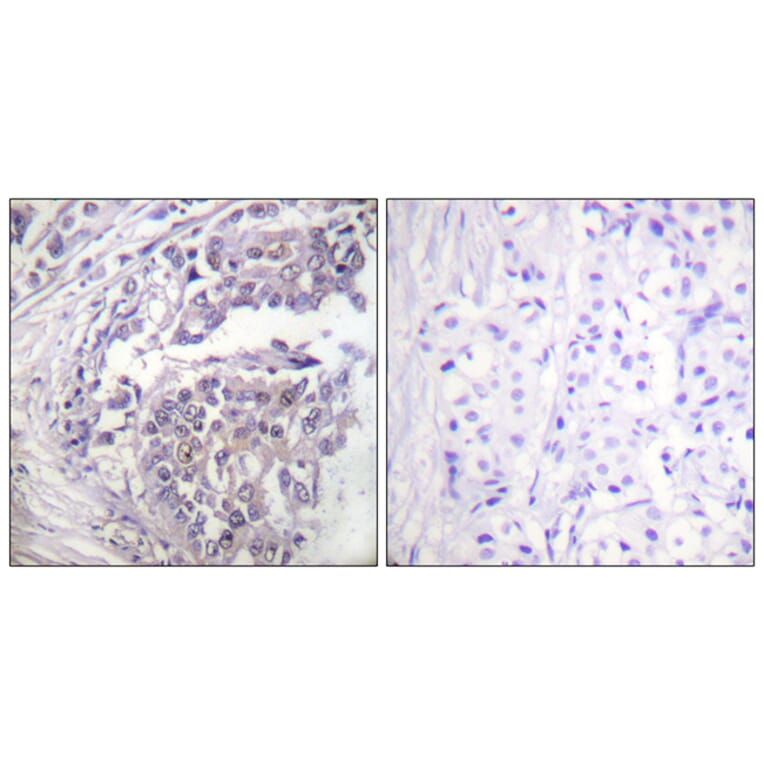 Immunohistochemistry - Anti-Histone H2B (acetyl Lys5) Antibody (D0003) - Antibodies.com