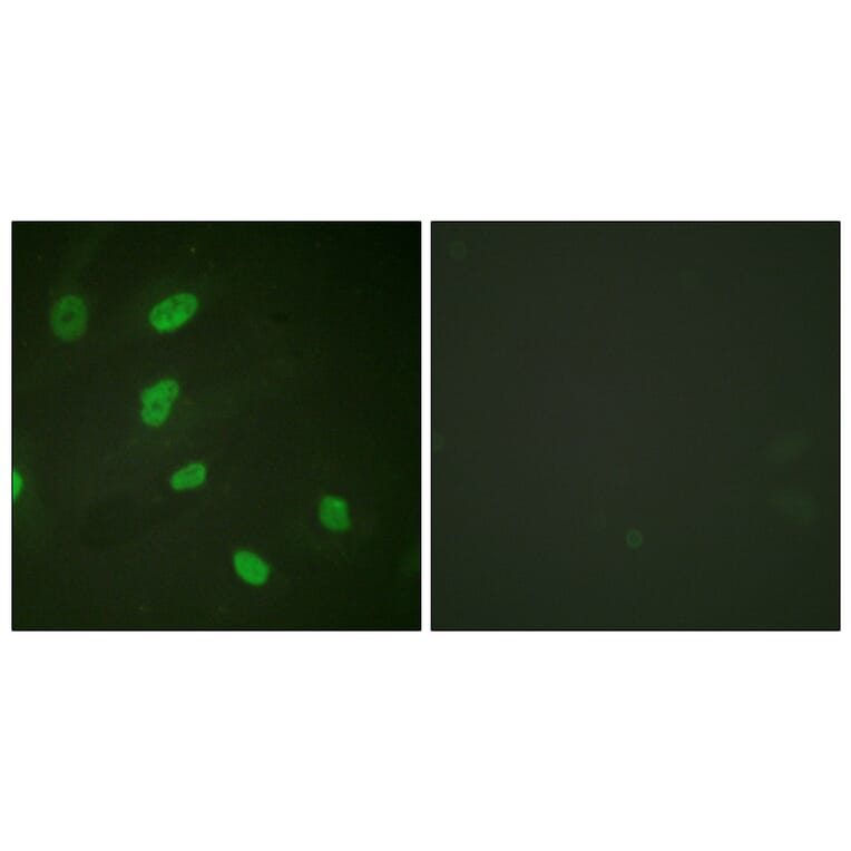 Immunofluorescence - Anti-Histone H2B (acetyl Lys5) Antibody (D0003) - Antibodies.com