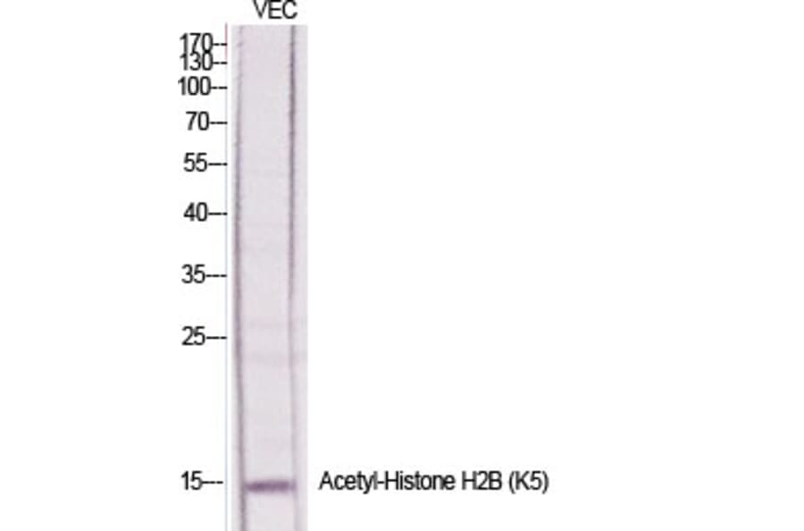 Western Blot - Anti-Histone H2B (acetyl Lys5) Antibody (D0003) - Antibodies.com