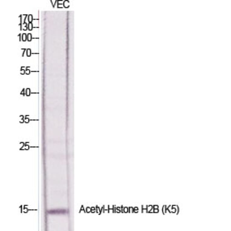 Western Blot - Anti-Histone H2B (acetyl Lys5) Antibody (D0003) - Antibodies.com