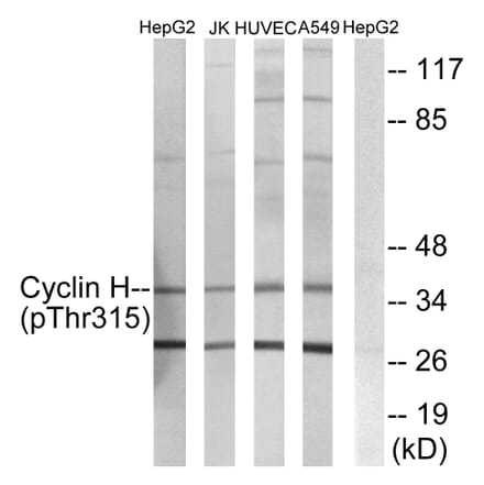 Western Blot - Anti-Cyclin H (phospho Thr315) Antibody (A0881) - Antibodies.com