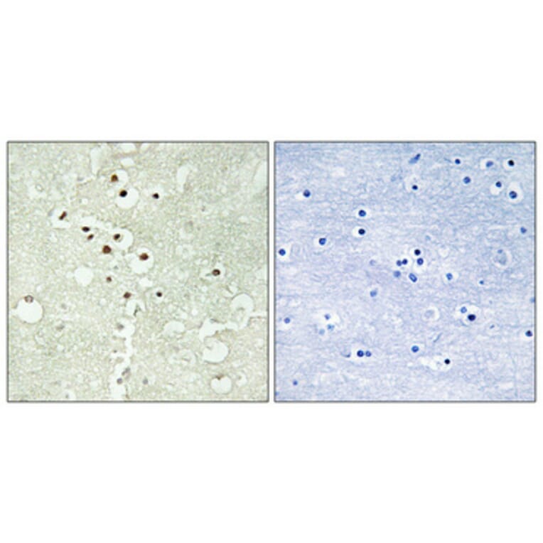 Immunohistochemistry - Anti-Cyclin H (phospho Thr315) Antibody (A0881) - Antibodies.com