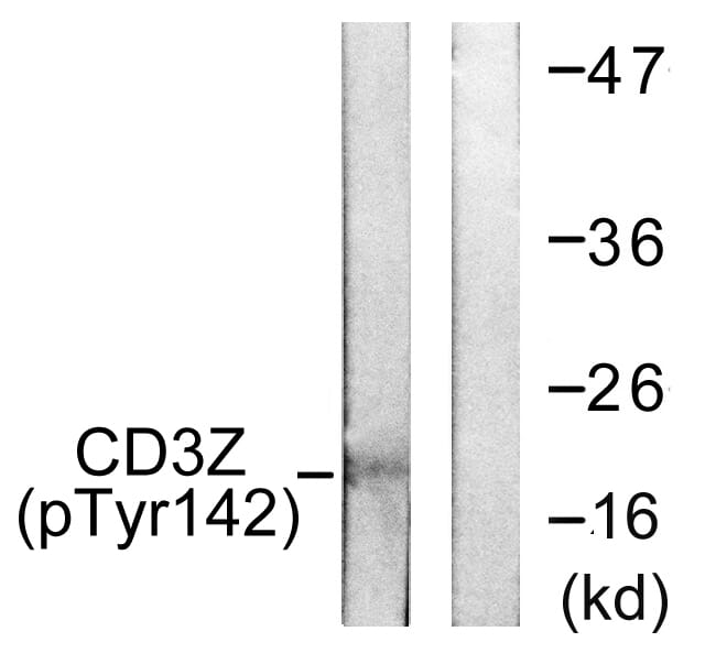 Anti-CD3 zeta (phospho Tyr142) Antibody (A94609) | Antibodies.com