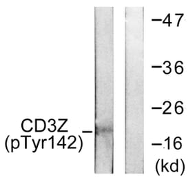 Western Blot - Anti-CD3 zeta (phospho Tyr142) Antibody (A0468) - Antibodies.com