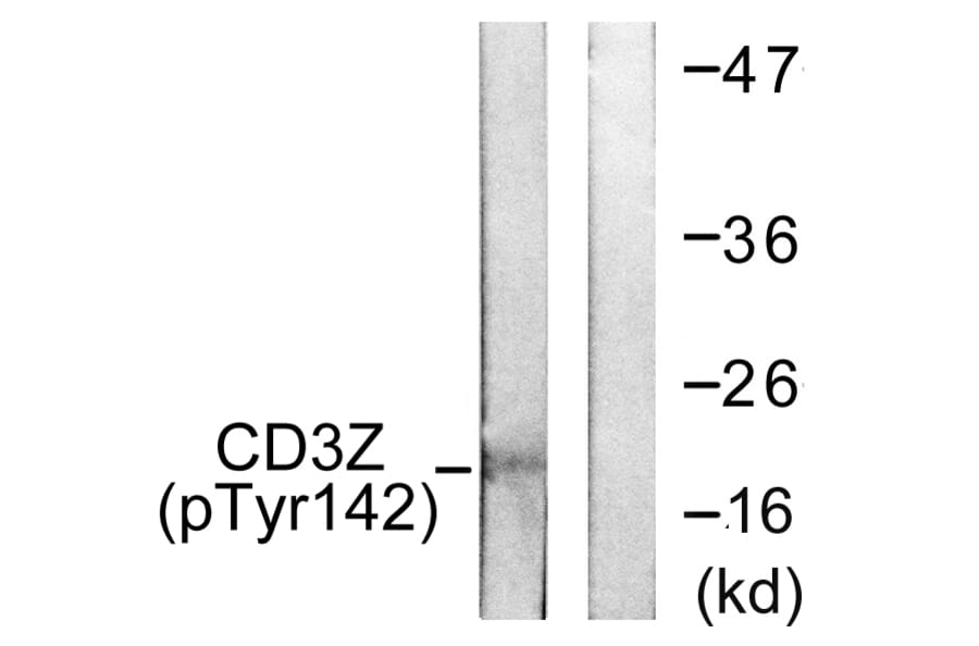 Western Blot - Anti-CD3 zeta (phospho Tyr142) Antibody (A0468) - Antibodies.com