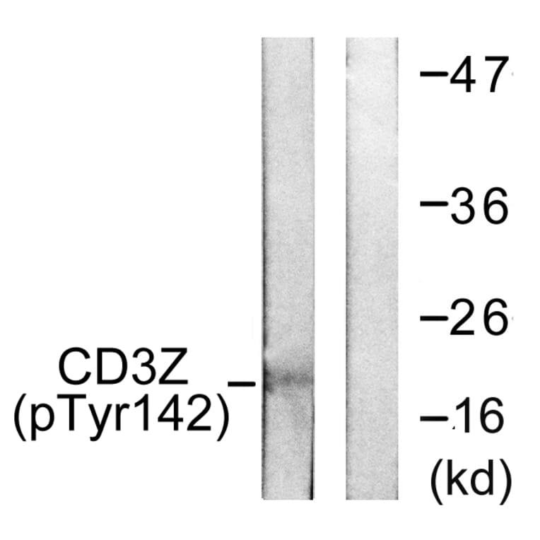 Western Blot - Anti-CD3 zeta (phospho Tyr142) Antibody (A0468) - Antibodies.com
