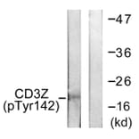 Western Blot - Anti-CD3 zeta (phospho Tyr142) Antibody (A0468) - Antibodies.com