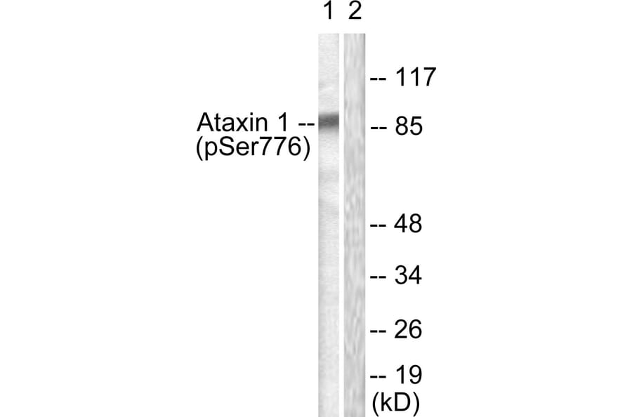 Western Blot - Anti-Ataxin 1 (phospho Ser776) Antibody (A0771) - Antibodies.com