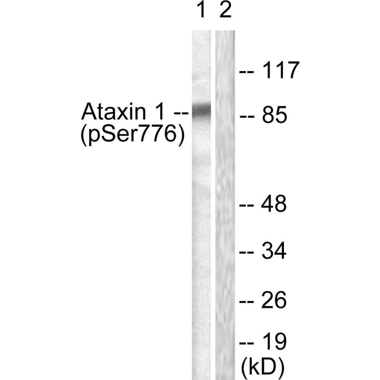 Western Blot - Anti-Ataxin 1 (phospho Ser776) Antibody (A0771) - Antibodies.com