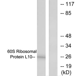 Western Blot - Anti-60S Ribosomal Protein L10 Antibody (C0391) - Antibodies.com