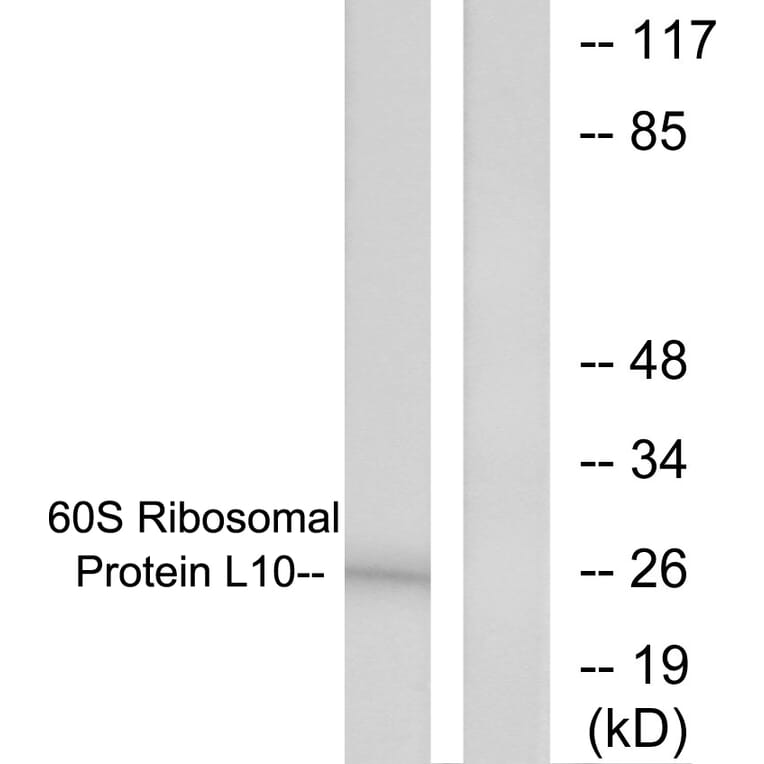 Western Blot - Anti-60S Ribosomal Protein L10 Antibody (C0391) - Antibodies.com