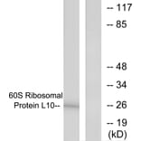 Western Blot - Anti-60S Ribosomal Protein L10 Antibody (C0391) - Antibodies.com