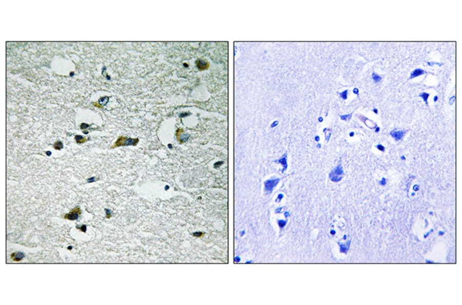 Immunohistochemistry - Anti-CSNK1G1 (phospho Tyr263) Antibody (A8089) - Antibodies.com