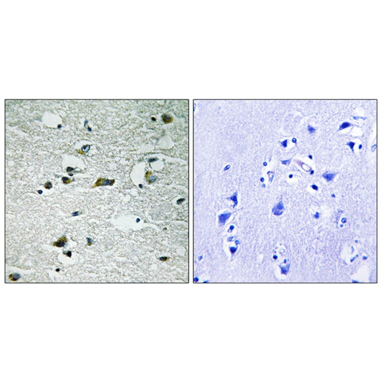 Immunohistochemistry - Anti-CSNK1G1 (phospho Tyr263) Antibody (A8089) - Antibodies.com