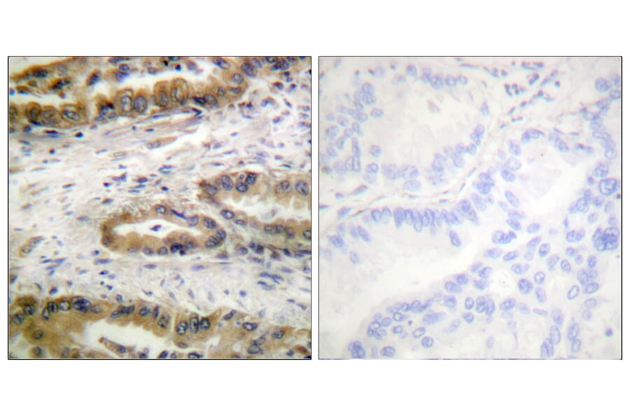 Immunohistochemistry - Anti-VEGFR2 (phospho Tyr1054) Antibody (A1014) - Antibodies.com
